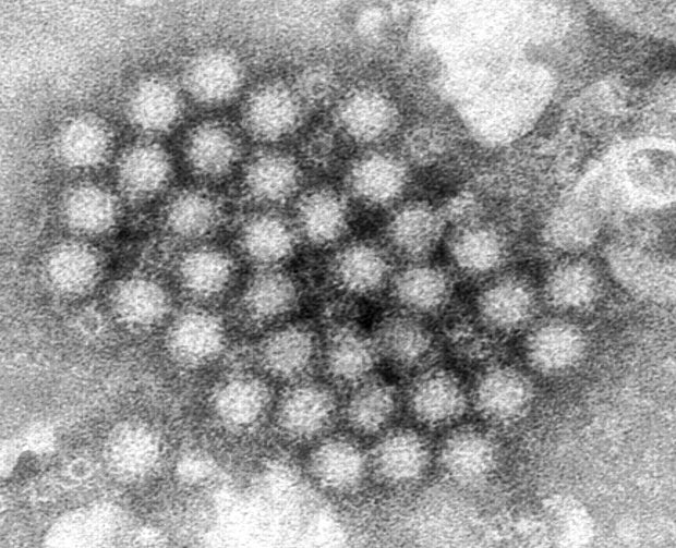 Norovirus infection – things to know