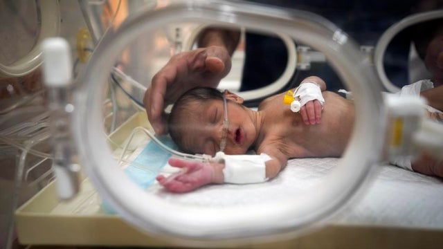 APTOPIX Israel Palestinians Gaza