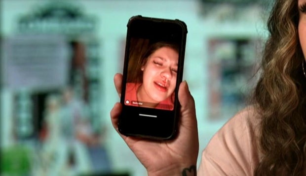 Livye Lewis injury pic