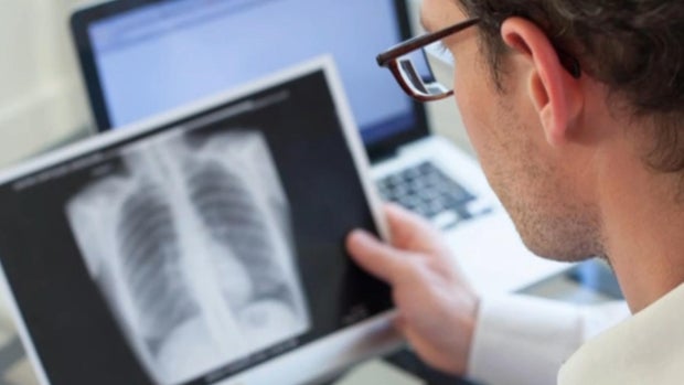 cbsn-fusion-kansas-faces-record-tuberculosis-outbreak-thumbnail.jpg 