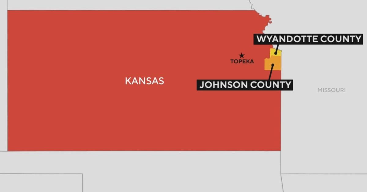 Kansas seeing largest tuberculosis outbreak in U.S. history, dozens of cases reported