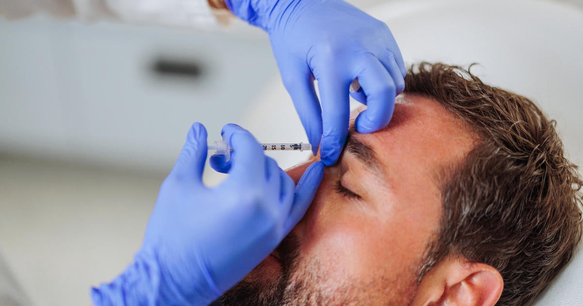 Doctors see rise in "Brotox" and other facial treatments for men