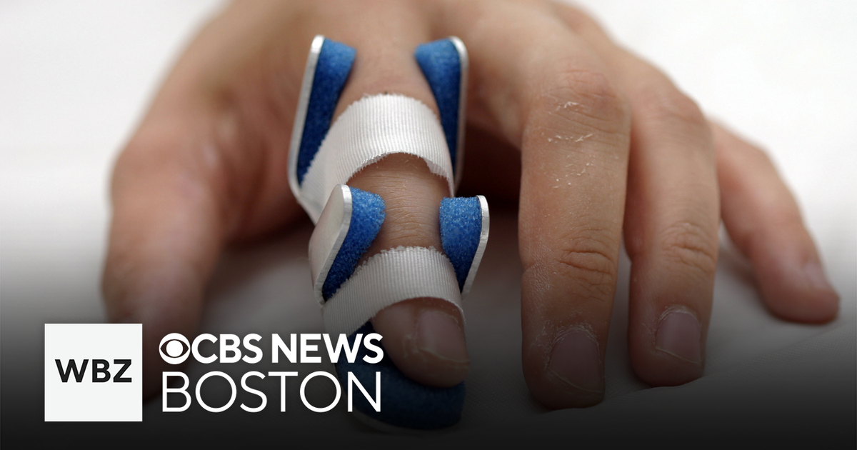 How to treat a jammed finger