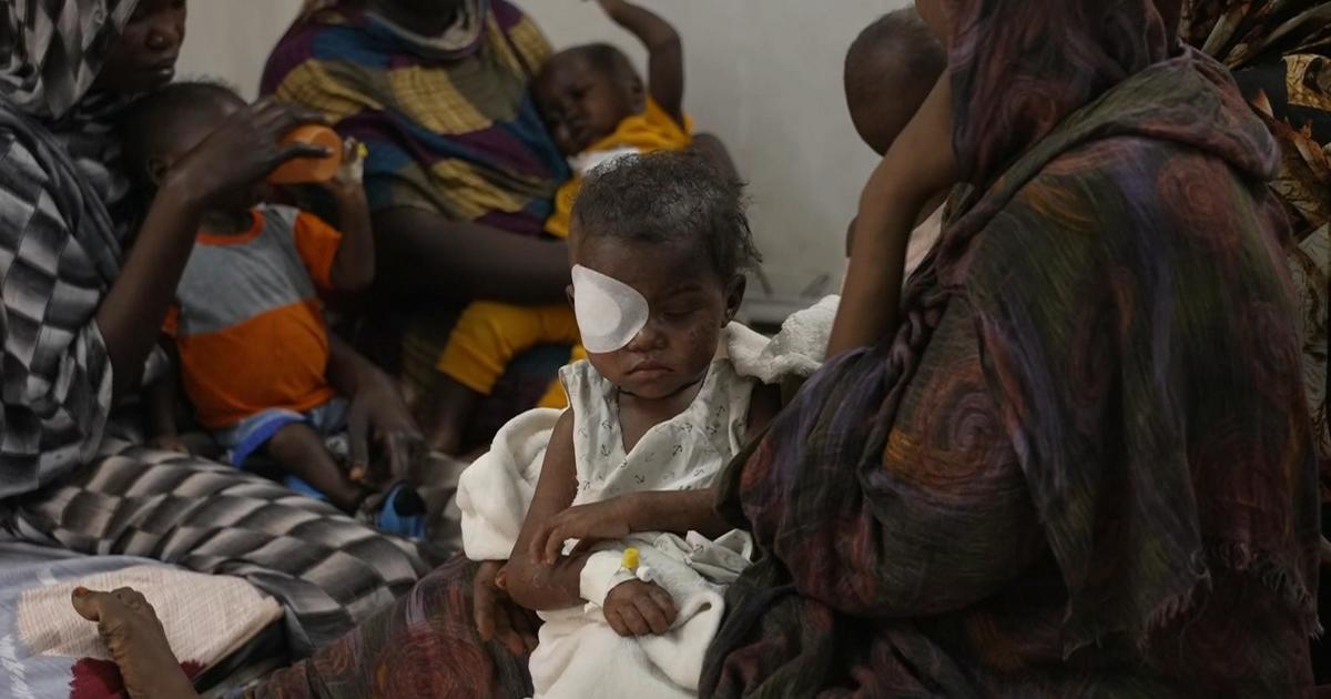 How shuttering USAID could impact famine, lives in Sudan