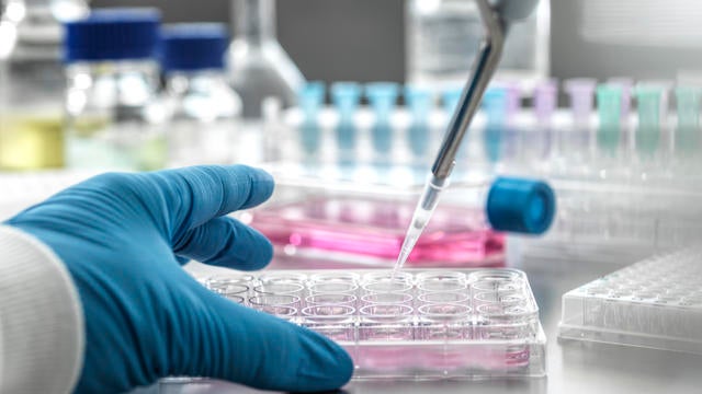 Scientist pipetting medical samples into microplate in laboratory 