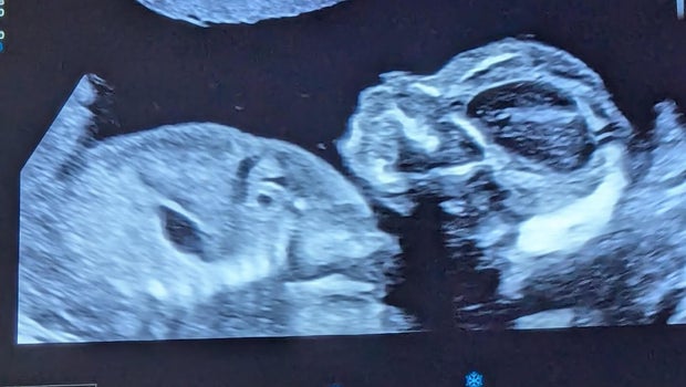 sonogram-august.jpg