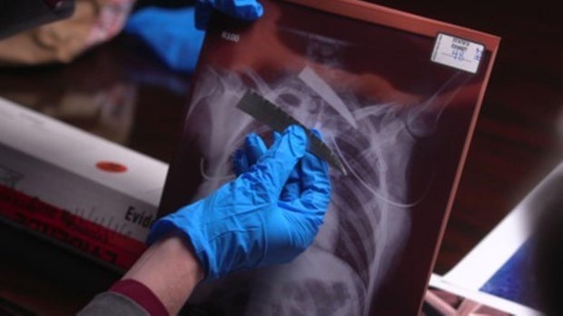 Cati Blauvelt evidence