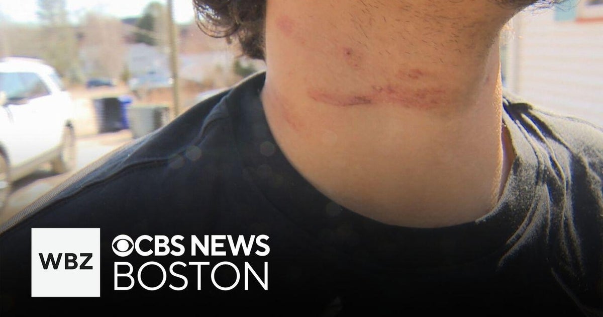 Teen says he was attacked during basketball game at Brighton YMCA - CBS ...