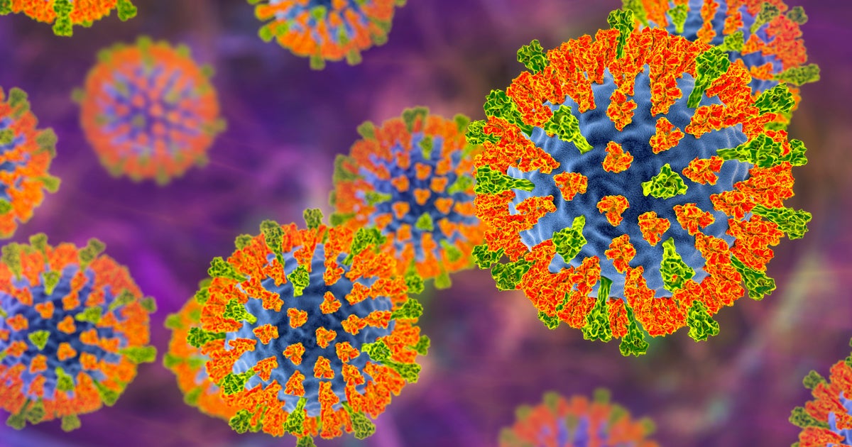 Public Health Alerts Issued for Measles Exposures in Foremost, Lethbridge, Metropolitan Perth, New York