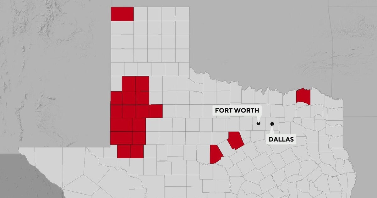 Texas Health Department reports surge in measles cases - CBS Texas