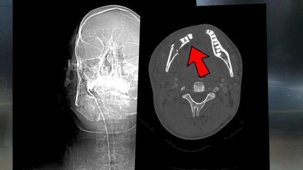 x-ray.jpg 
