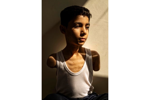 Netherlands World Press Photo 