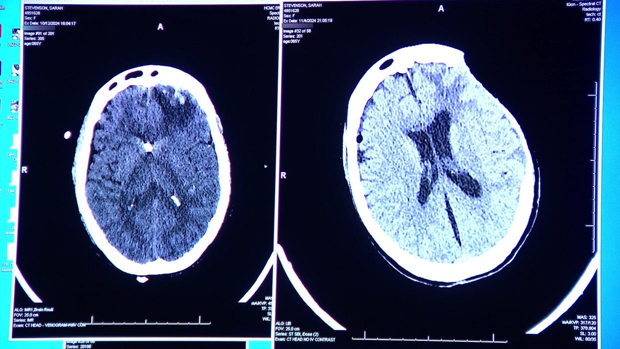 7a-pkg-coma-miracle-wcco7ljy.jpg 