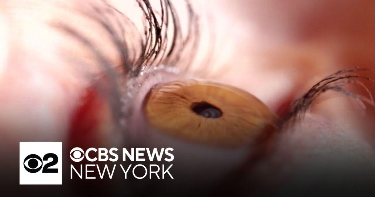 New research shows promise in restoring vision - CBS New York