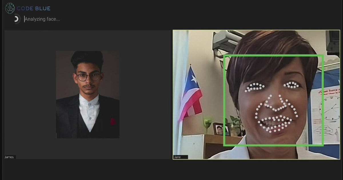 Bay Area startup Code Blue using AI for early detection of strokes
