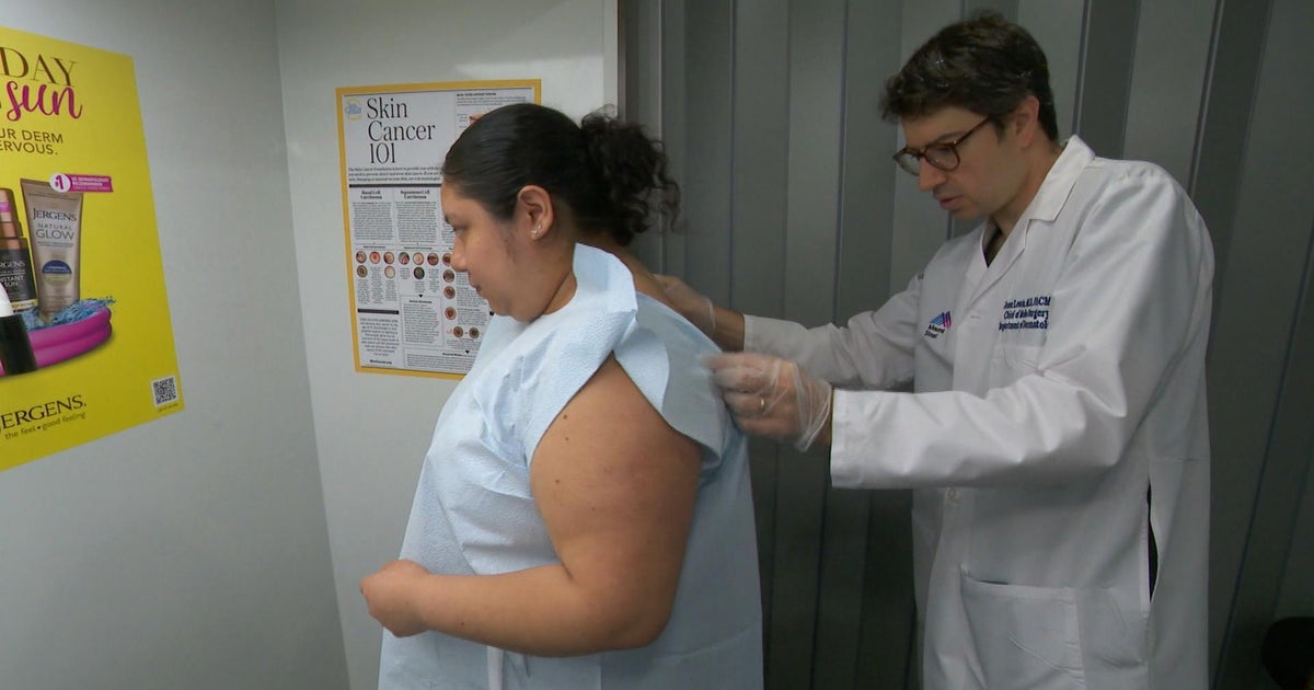 As summer nears, experts urge skin cancer screenings and sun safety