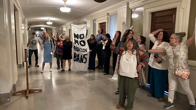 US Abortion Missouri 