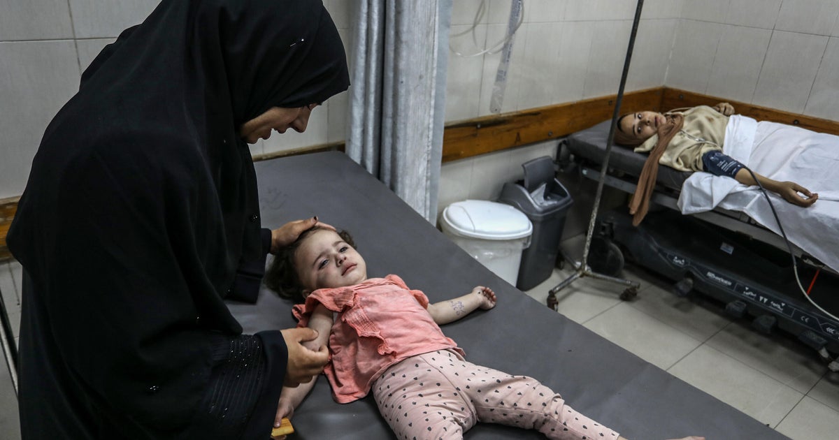 Trump, İsrail'in saldırısından ölüm ücretinin 53.000'e ulaştığı için Gazze'de “birçok insan açlıktan ölüyor” diyor