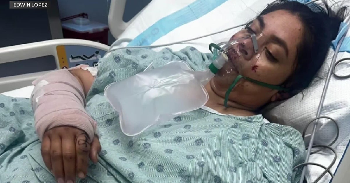 Miami police search for driver in hit-and-run that left food delivery worker critically injured