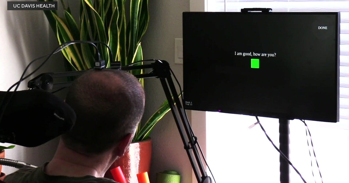 UC Davis breakthrough lets ALS patient speak using only his thoughts 