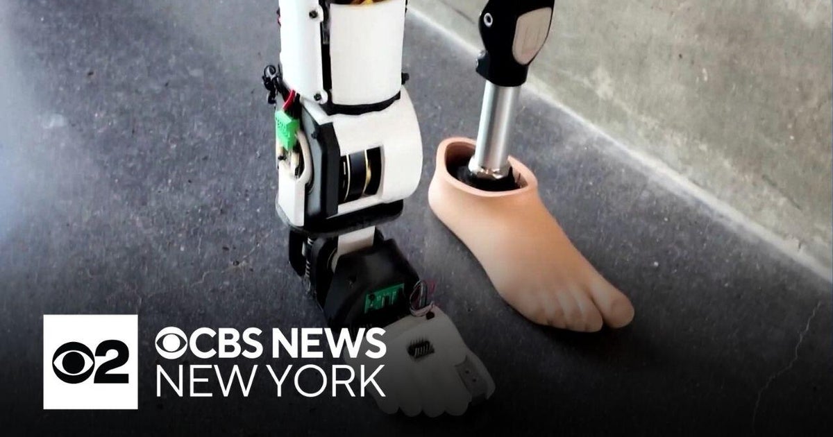 High students invent bionic leg controlled by users' brain - CBS New York