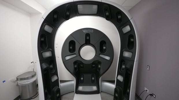 Vectra WB180 system