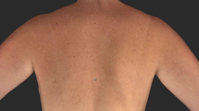 A 3-D avatar of a patient's body. 