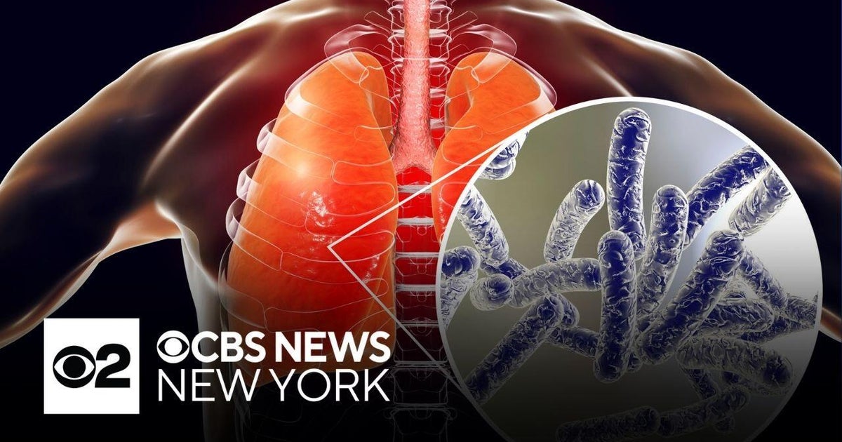 Legionnaires' disease cluster found in Harlem, NYC Health says CBS