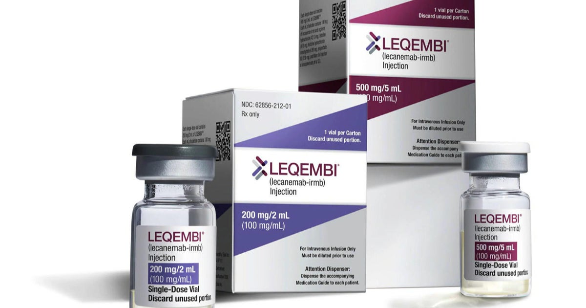 New advances offer hope in Alzheimer's detection and treatment