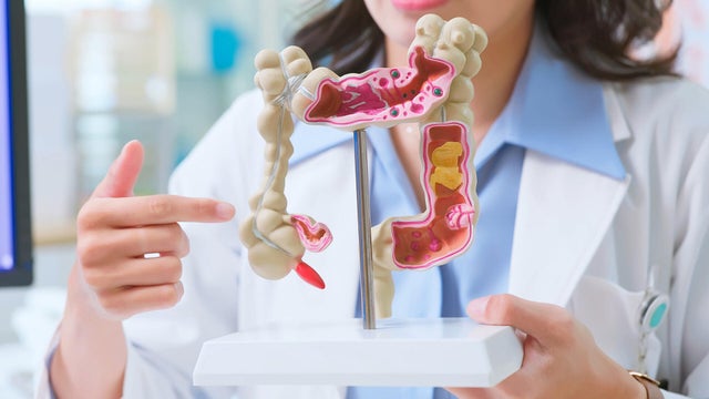 colon.jpg 