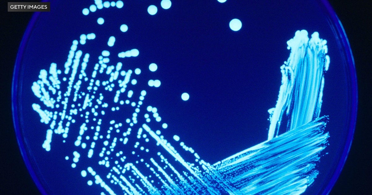 Legionella bacteria detected at Berks County, Pennsylvania buildings 