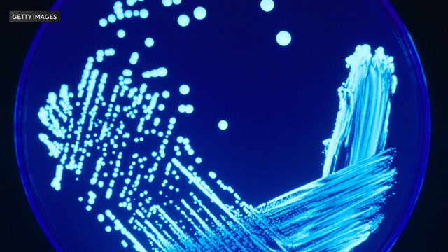 legionella-bacteria-getty-images.jpg 