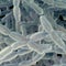 What to know about Legionnaires' disease breakouts in New York, Michigan