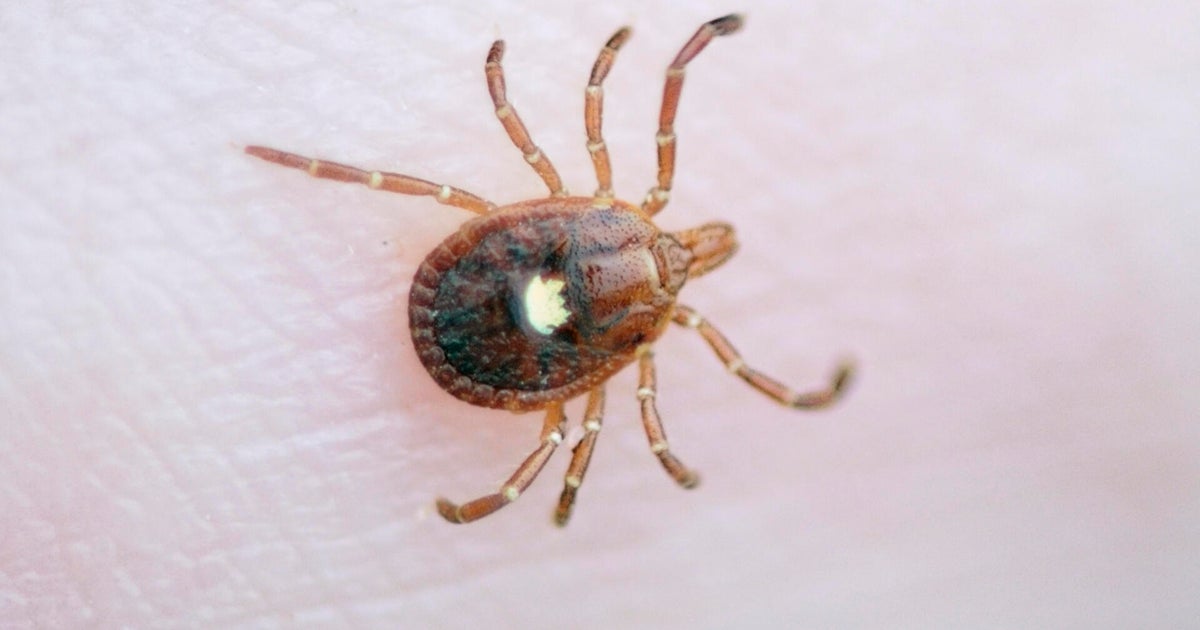 Meat, dairy allergies from tick bites “skyrocketing” on Martha’s Vineyard, expert says