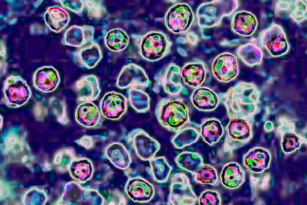Measles Virus 