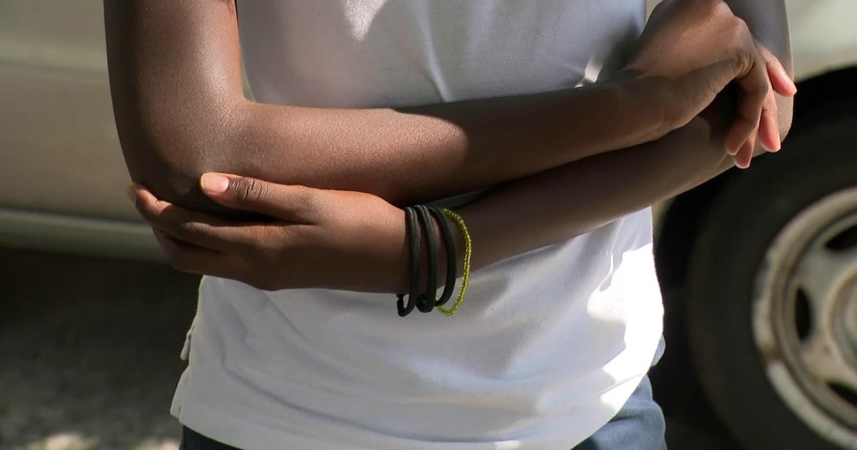 North Miami girl, 12, speaks out after escaping attempted kidnapping