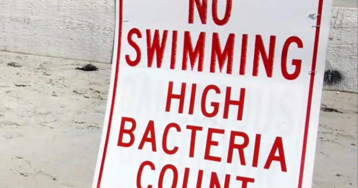 Hundreds of beaches closed for Labor Day over bacteria concerns