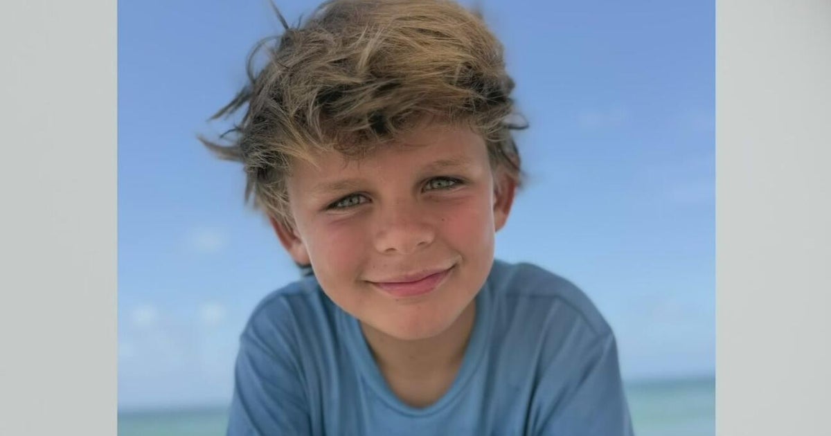 Doctors talk about treating child bitten by shark off Key Largo