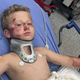 8-year-old boy on bicycle recovering after hit-and-run in Fort Worth 
