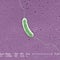 Flesh-eating bacteria kills 5th person this year in Louisiana