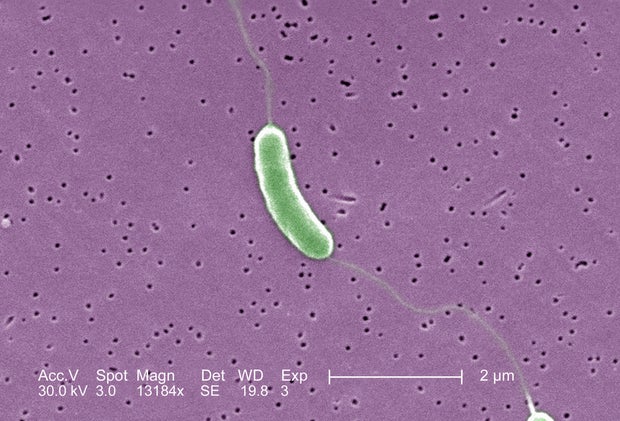SEM of Vibrio vulnificus bacteria 