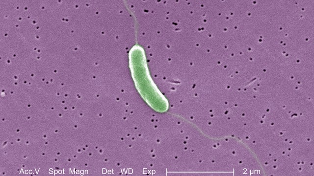 SEM of Vibrio vulnificus bacteria 