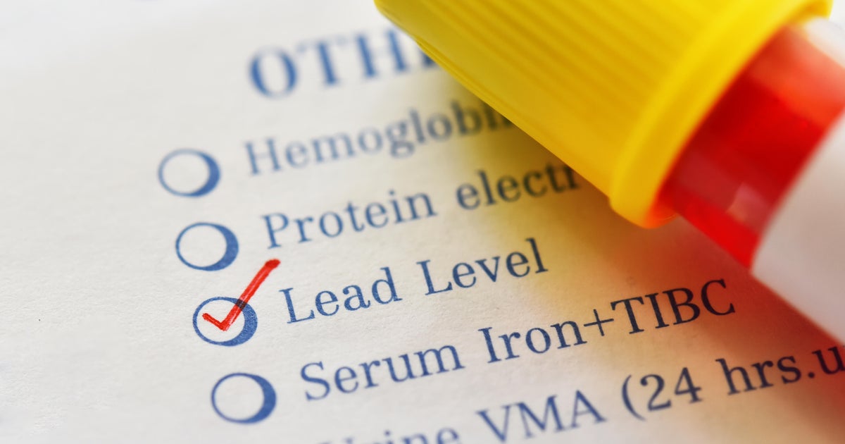 New blood lead level standards coming for Minnesota workers after WCCO ...