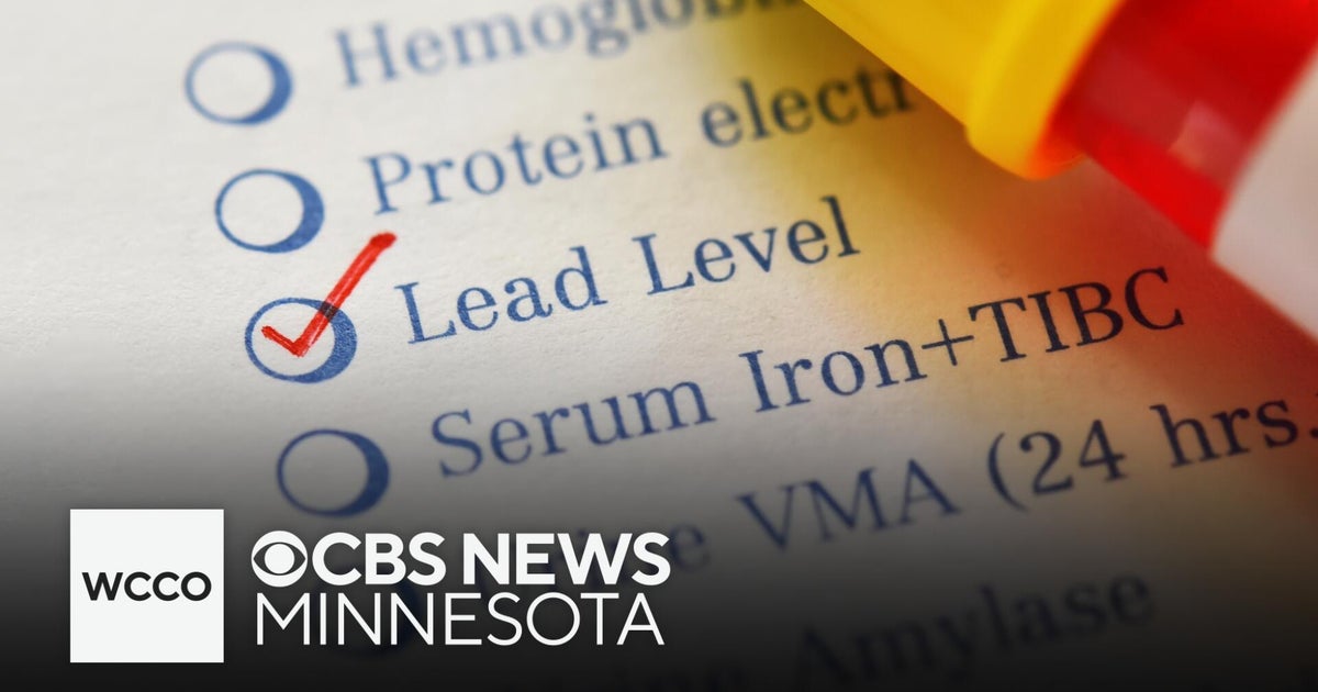 Blood lead levels standard will change after WCCO investigation ...