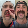 Huntington Beach dentist helps Marine veteran who broke tooth while surfing 