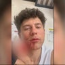 Los Angeles man pulled from car and beaten in road rage incident 