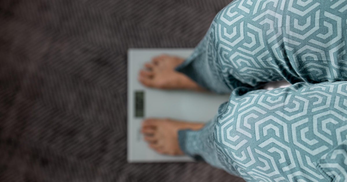 Nearly 70% of U.S. adults would be considered obese under proposed new definition, study finds