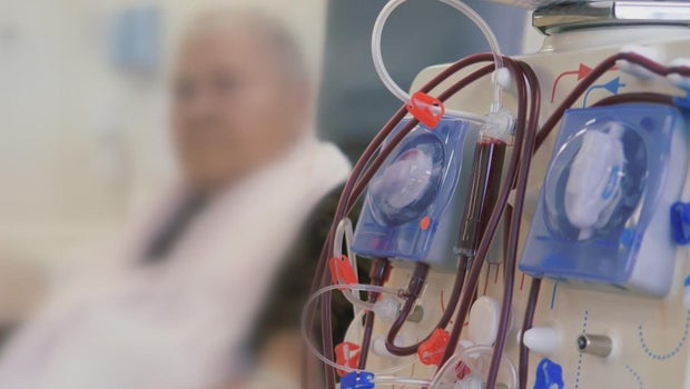 Death rates at U.S. dialysis clinics among the highest in the industrialized world