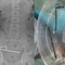 Surgeons remove dozens of magnets from teen's stomach