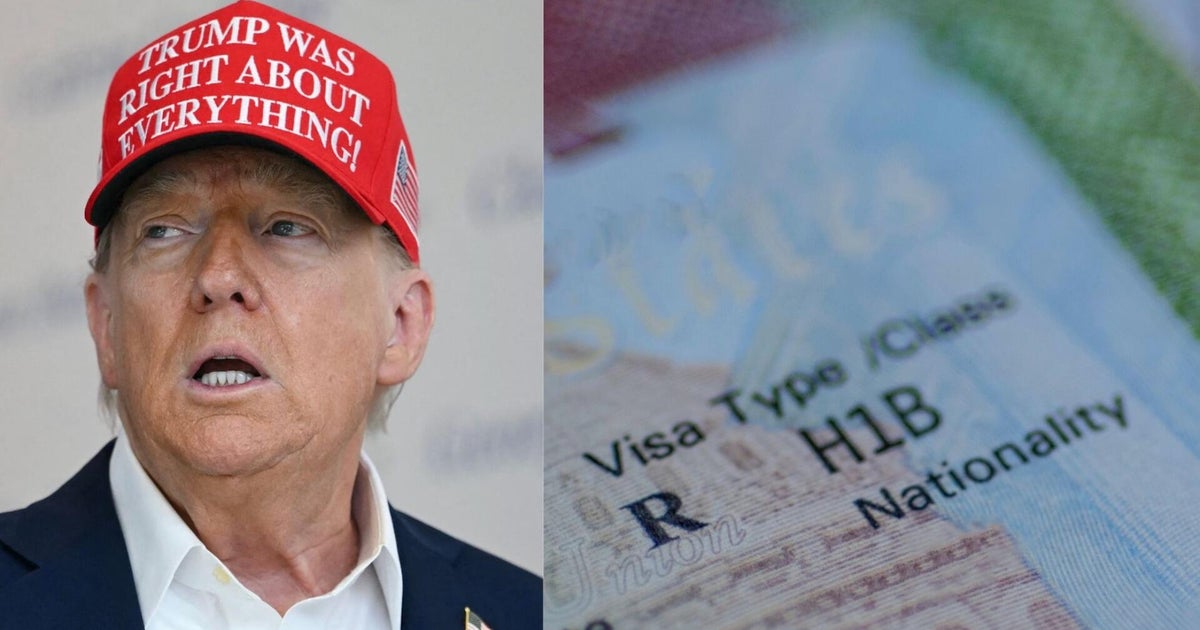 Rural and underserved hospitals hit hard by Trump administration's new H-1B visa fee